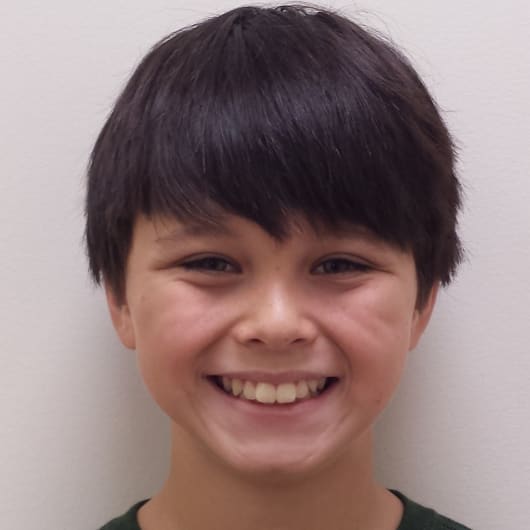 Patient Photo Before Treatment at All Star Smiles Orthodontics