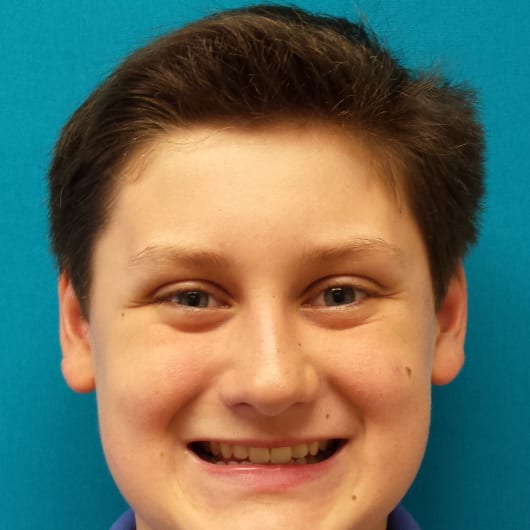 Patient Photo Before Treatment at All Star Smiles Orthodontics