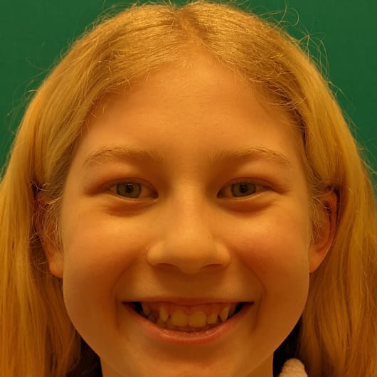 Patient Photo Before Treatment at All Star Smiles Orthodontics
