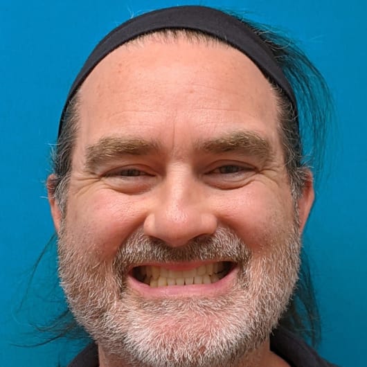 Patient Photo Before Treatment at All Star Smiles Orthodontics