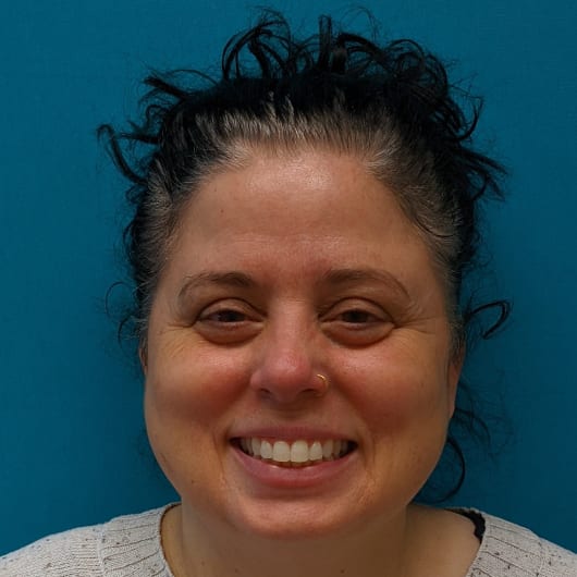 Patient Photo Before Treatment at All Star Smiles Orthodontics