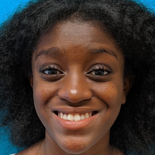 Patient Photo Before Treatment at All Star Smiles Orthodontics