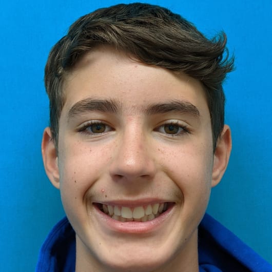 Patient Photo Before Treatment at All Star Smiles Orthodontics