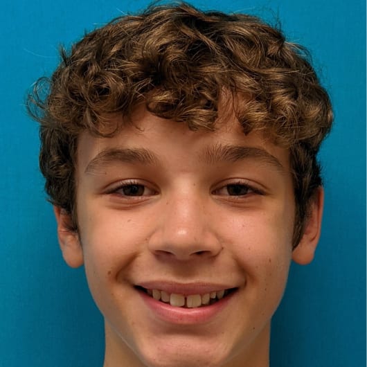 Patient Photo Before Treatment at All Star Smiles Orthodontics