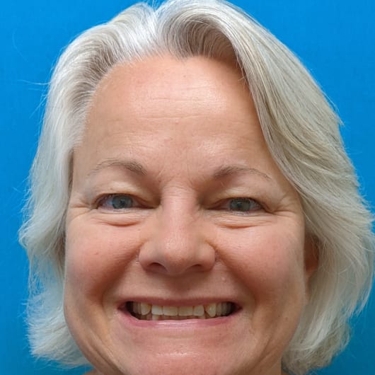 Patient Photo Before Treatment at All Star Smiles Orthodontics