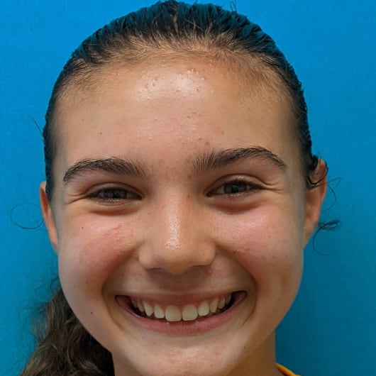 Patient Photo Before Treatment at All Star Smiles Orthodontics