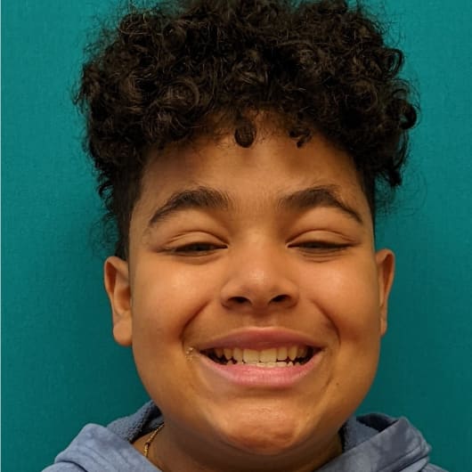 Patient Photo Before Treatment at All Star Smiles Orthodontics