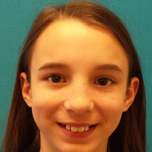 Patient Photo Before Treatment at All Star Smiles Orthodontics