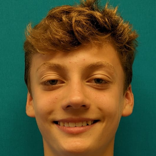 Patient Photo Before Treatment at All Star Smiles Orthodontics