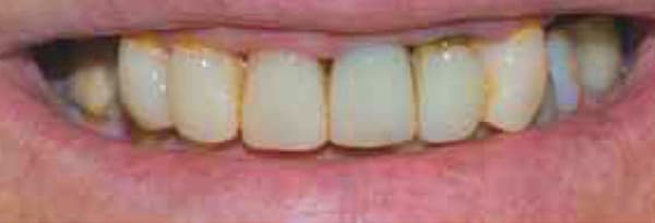 Before