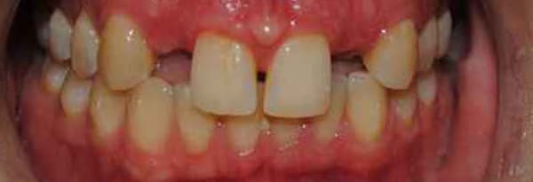 Before